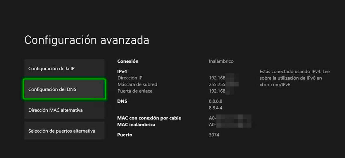 Análisis NordVPN - Xbox